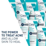 Cerave Acne Foaming Cream Cleanser with 4% Benzoyl Peroxide (150ml) - Image 5